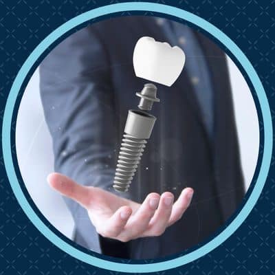 Dental implants vs. Other options 5 Dental implants